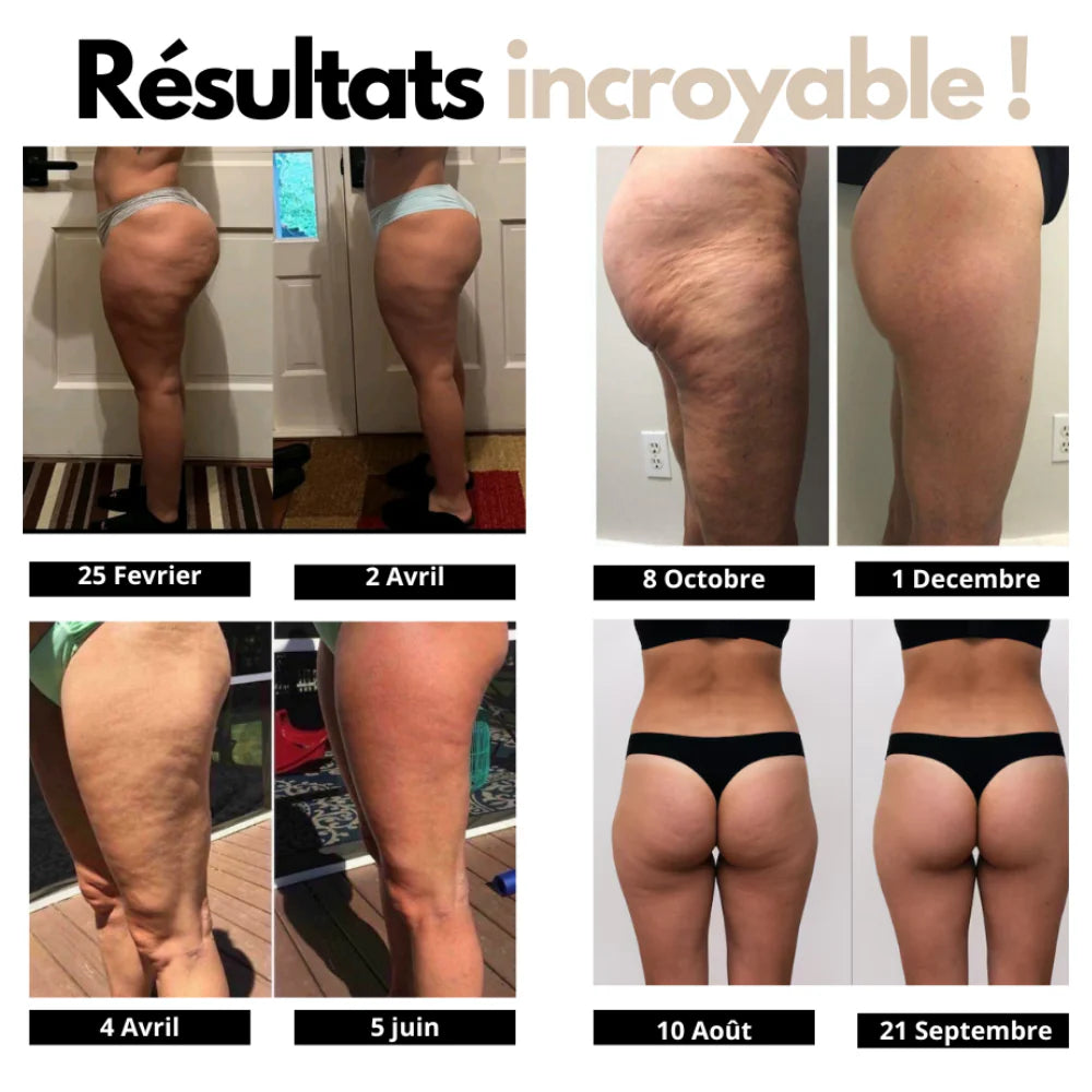 Legging 3D Lissant Cellulite & Peau d’Orange